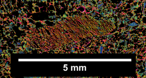 Image 3. Red, fused, angular Semifusinite